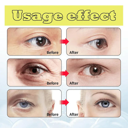 Celimax Retinal Shot