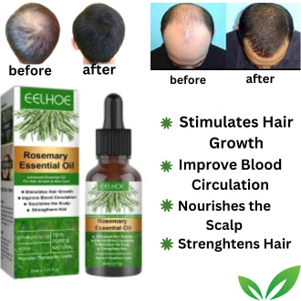 Eelhoe Rosemary Essential Hair Oil